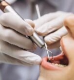 2-Why-Saving-Your-Natural-Tooth-with-a-Root-Canal-is-Important