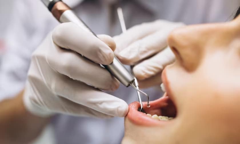 2-Why-Saving-Your-Natural-Tooth-with-a-Root-Canal-is-Important